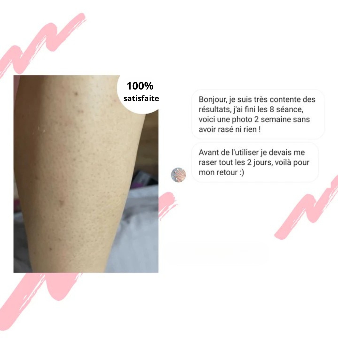 Épilateur à lumière pulsée