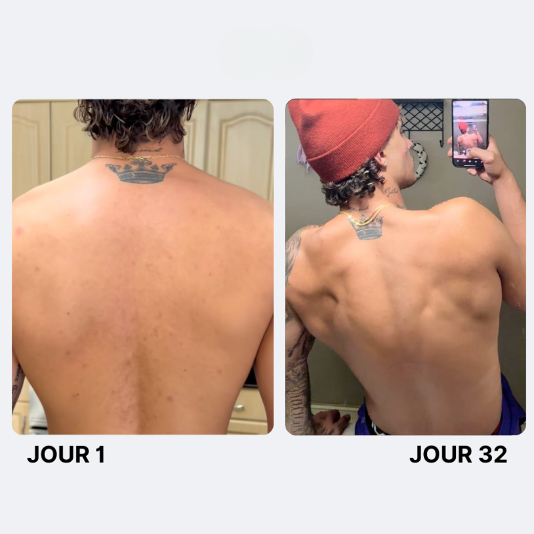 Savon Purifiant Anti-Acné