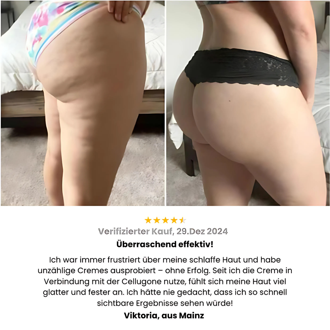 Anti-Cellulite Gerät mit Vakuum & Wärme