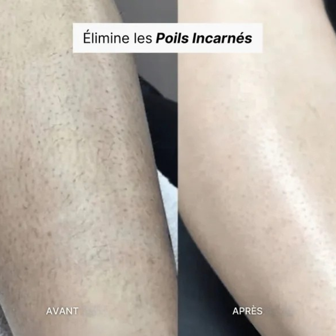 Épilateur exfoliant doux