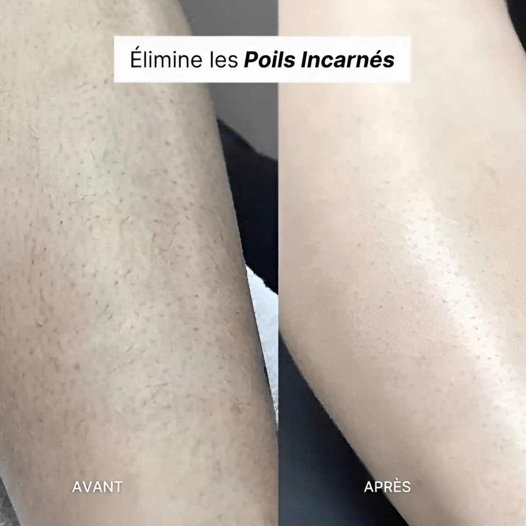 Rasoir Électrique Précision