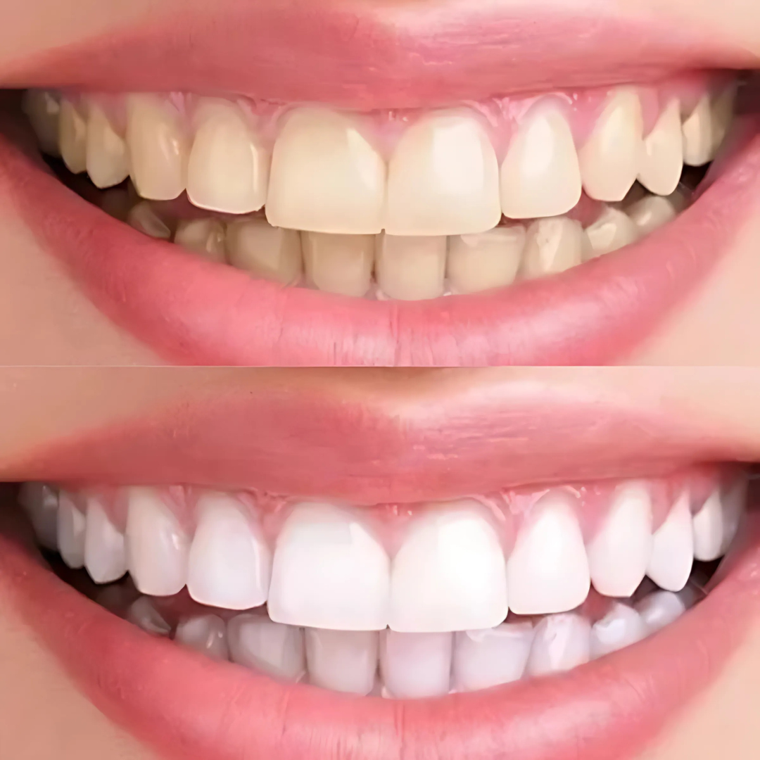 Violettes Zahnserum gegen Gelbstich