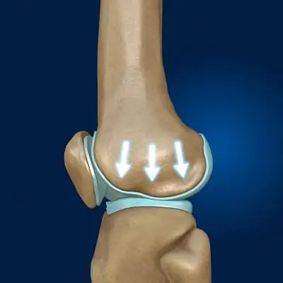 Genouillère Thérapeutique Antidouleur à Effet Ciblé