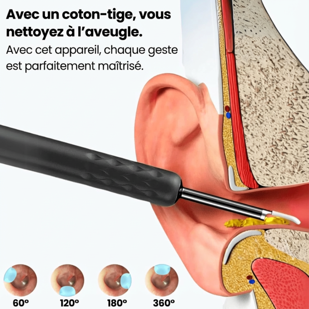Nettoyeur d’oreilles avec caméra HD