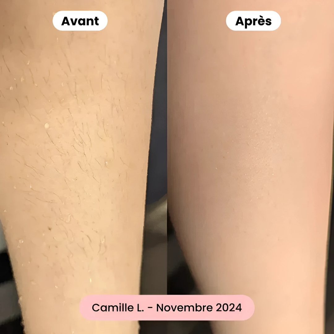 Rasoir électrique 2-en-1 femme