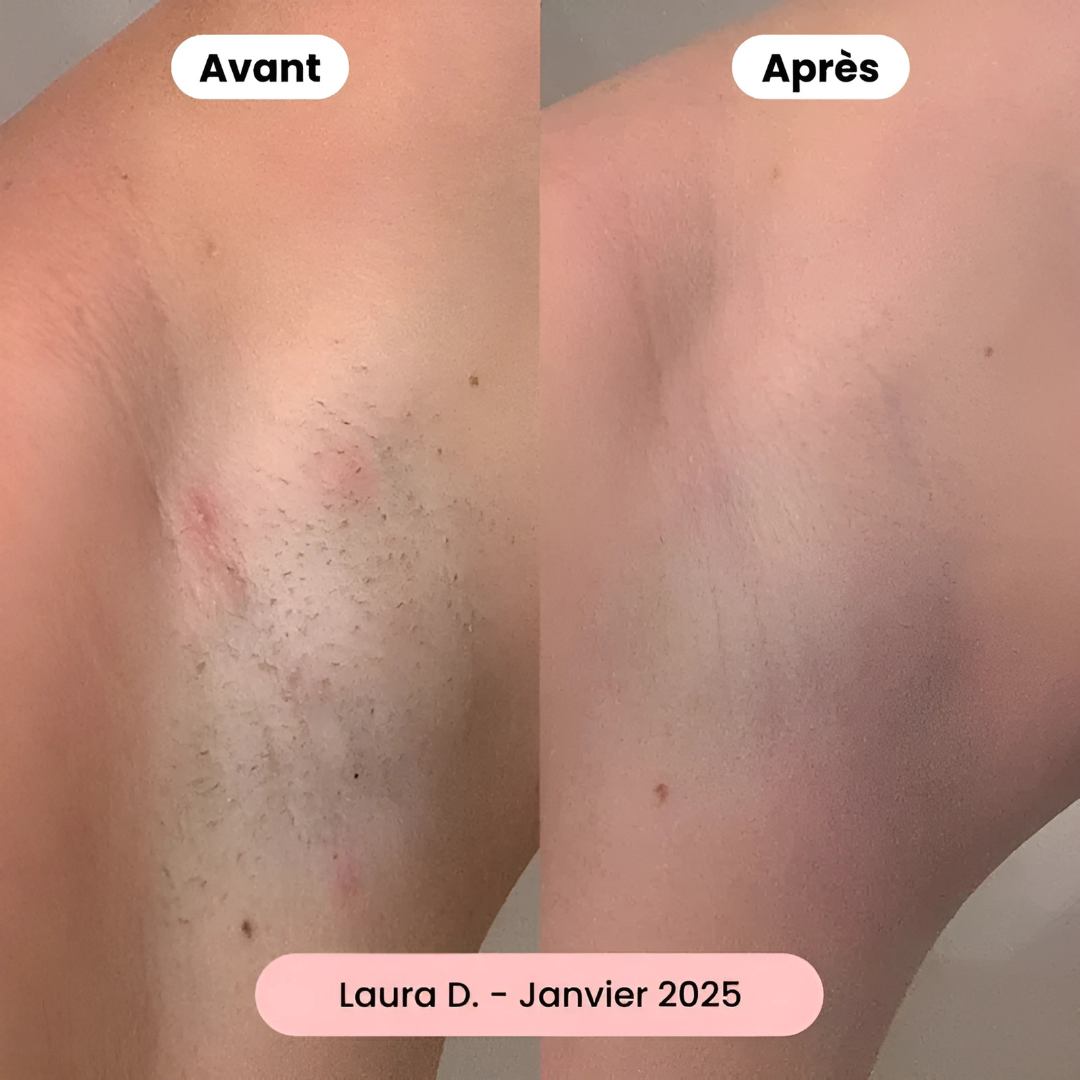 Rasoir électrique 2-en-1 femme