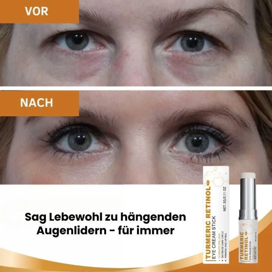 Raffermit les paupières tombantes de 87 % en seulement 2 heures