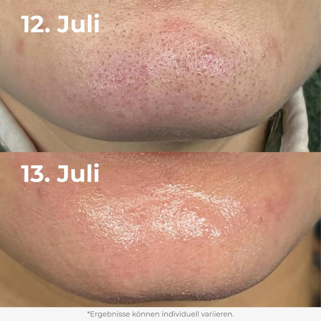 Glow Rice Peeling Duo