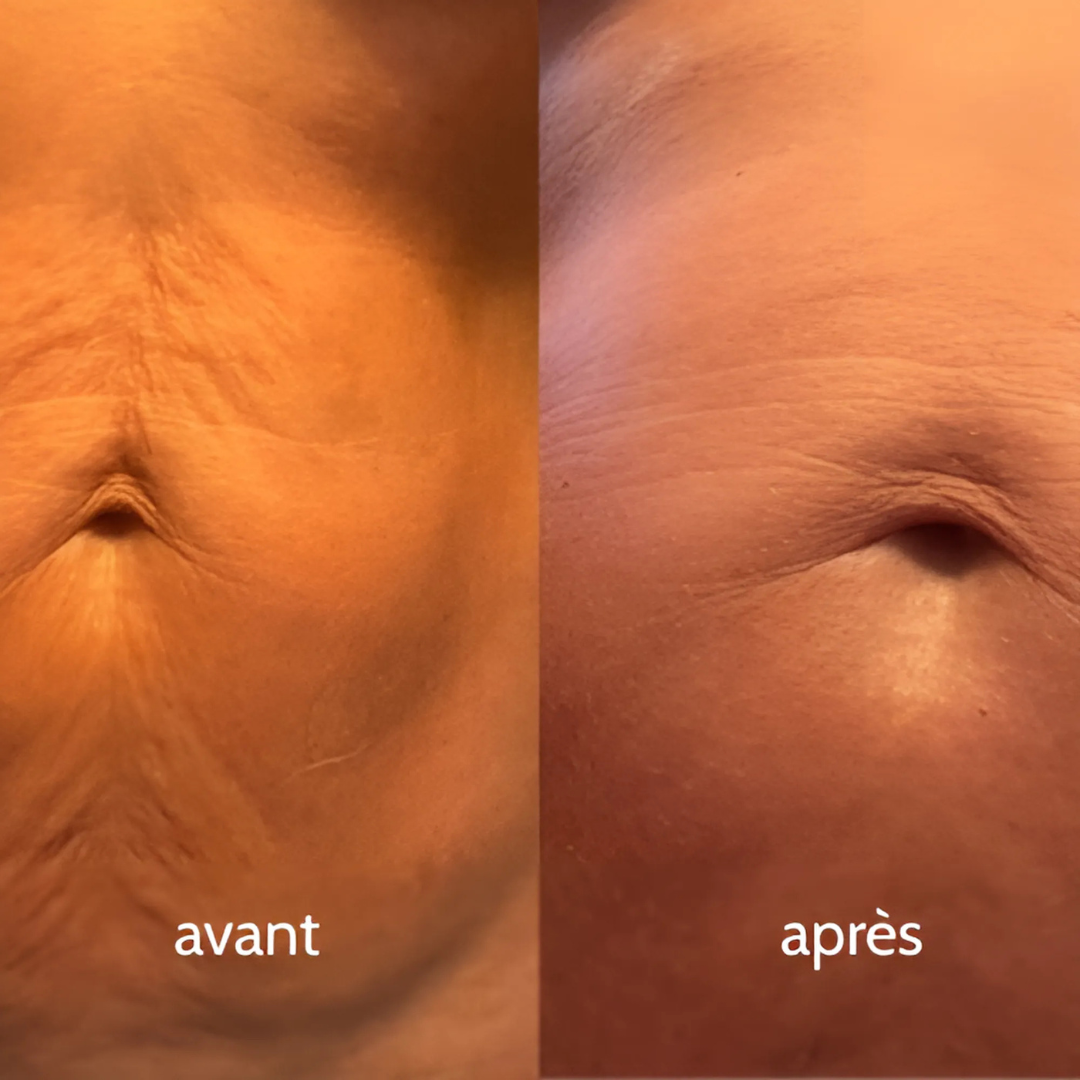 Sérum raffermissant bras & jambes