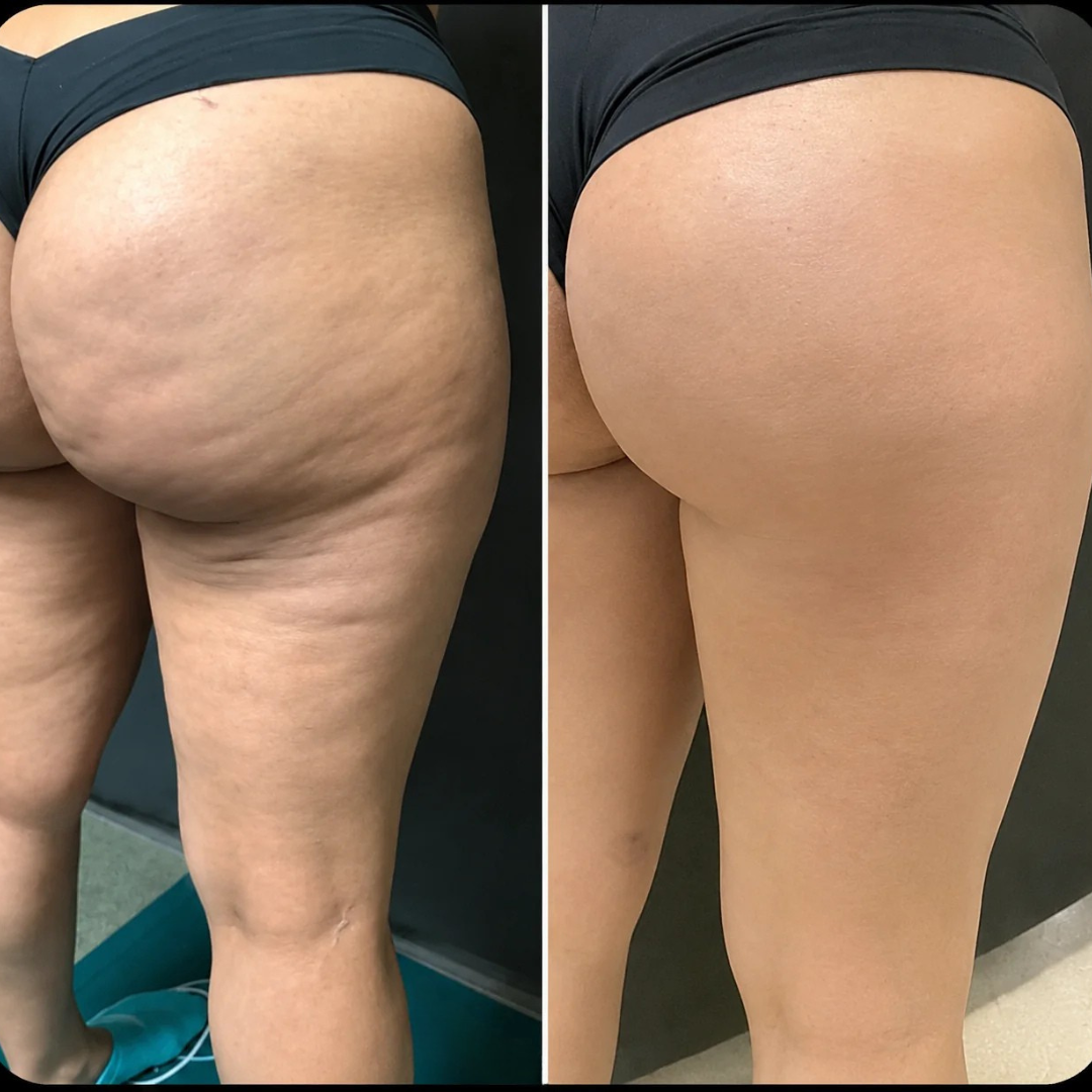 Masseur de Jambes Portable