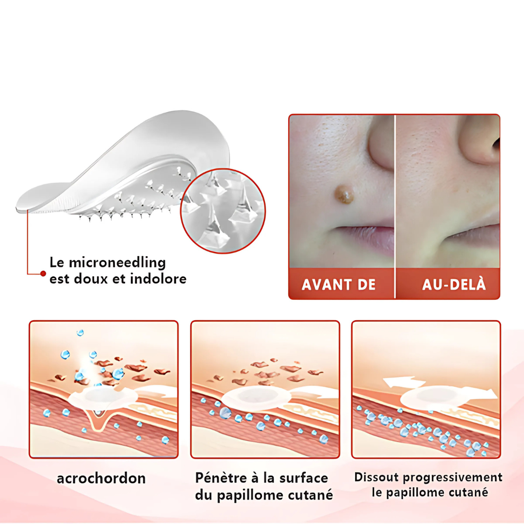 Patch Anti-Douleur MicroPatch