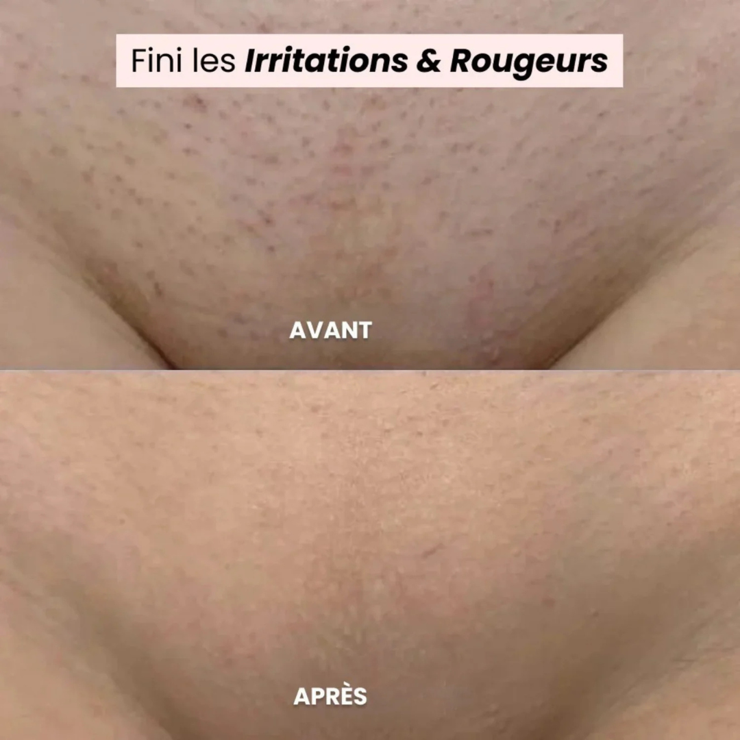 Rasoir électrique zones sensibles