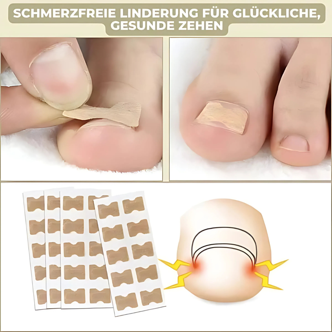 FixaNail Sofortige Nagelreparatur Patches – 25 + 25 Gratis