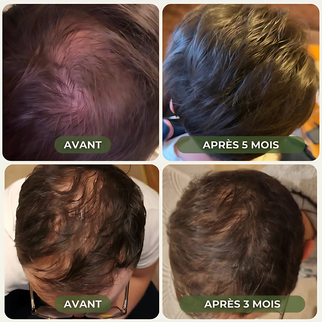 Shampoing Solide Fortifiant Naturel