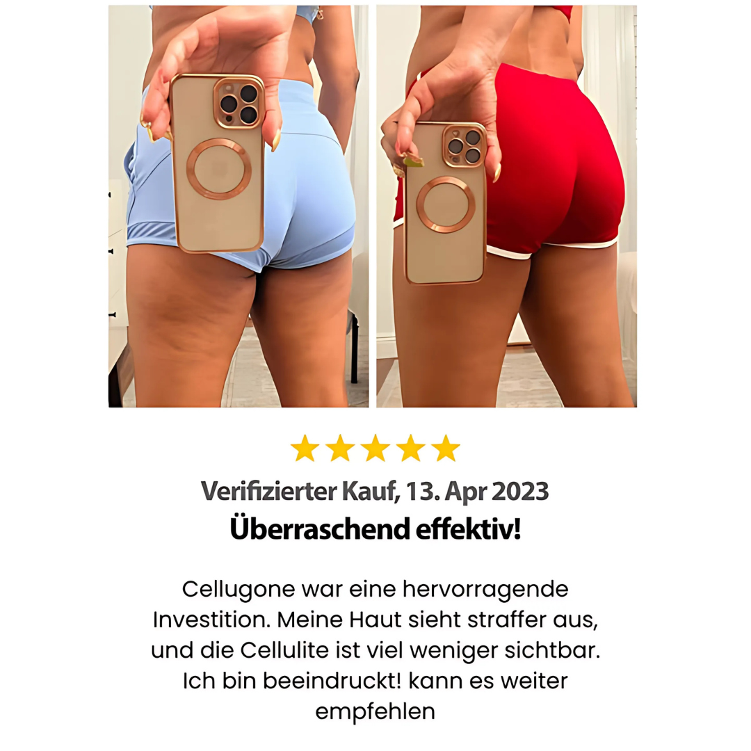 Anti-Cellulite Gerät mit Vakuum & Wärme