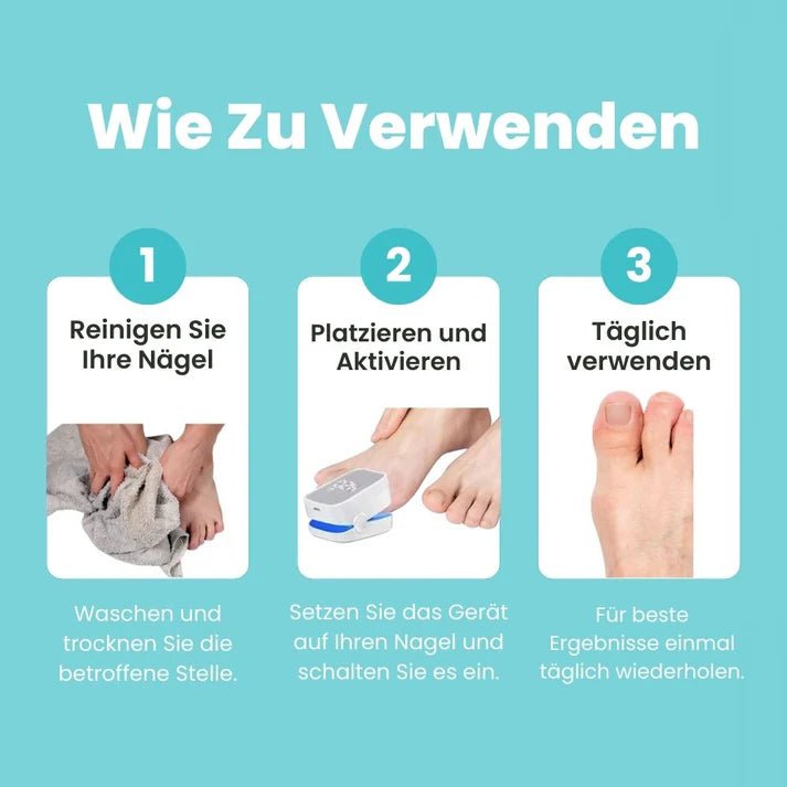 FungiClear Pro™ – Lasergerät gegen Nagelpilz
