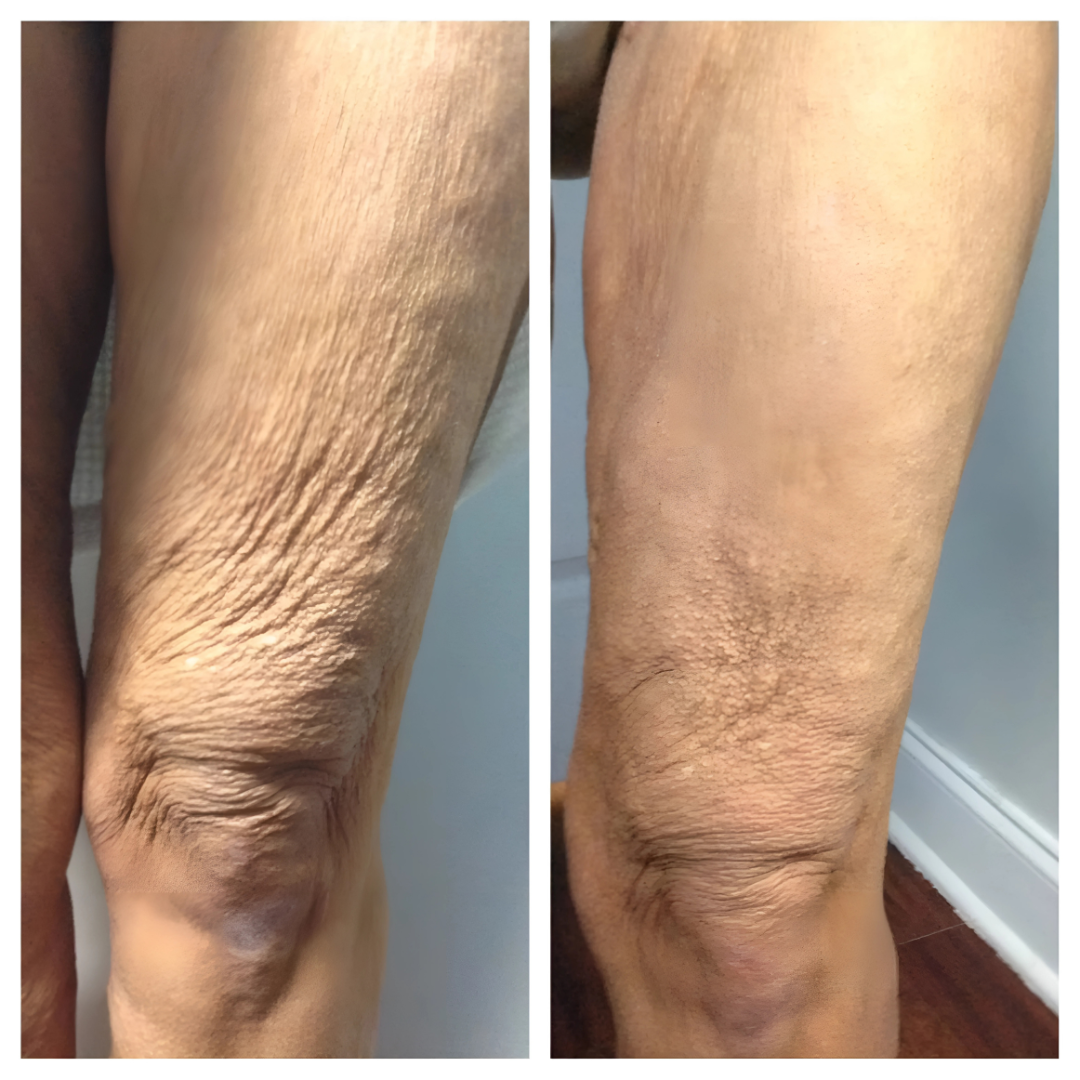 Sérum raffermissant bras & jambes