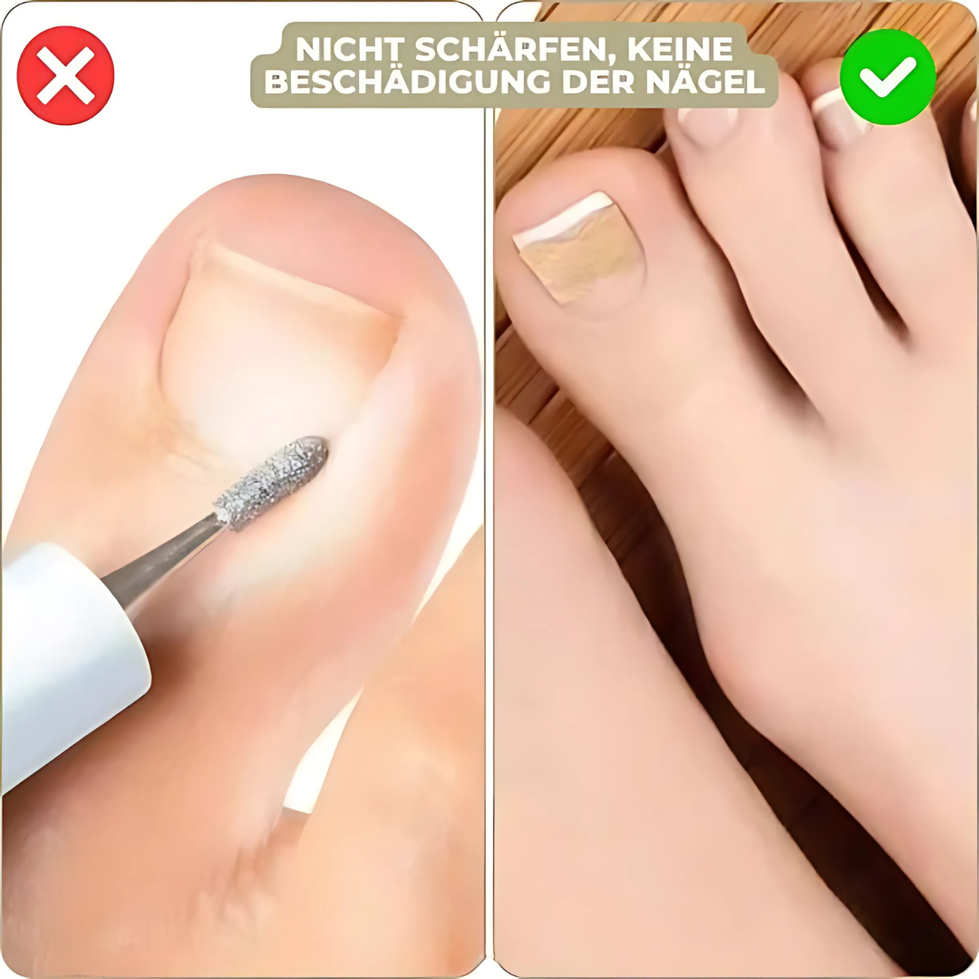 FixaNail Sofortige Nagelreparatur Patches – 25 + 25 Gratis