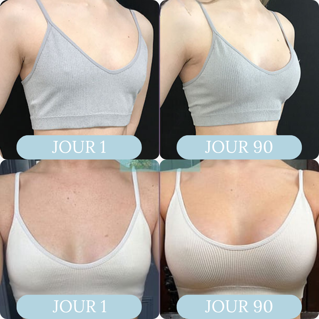 BUST'UP - Patch Mammaire