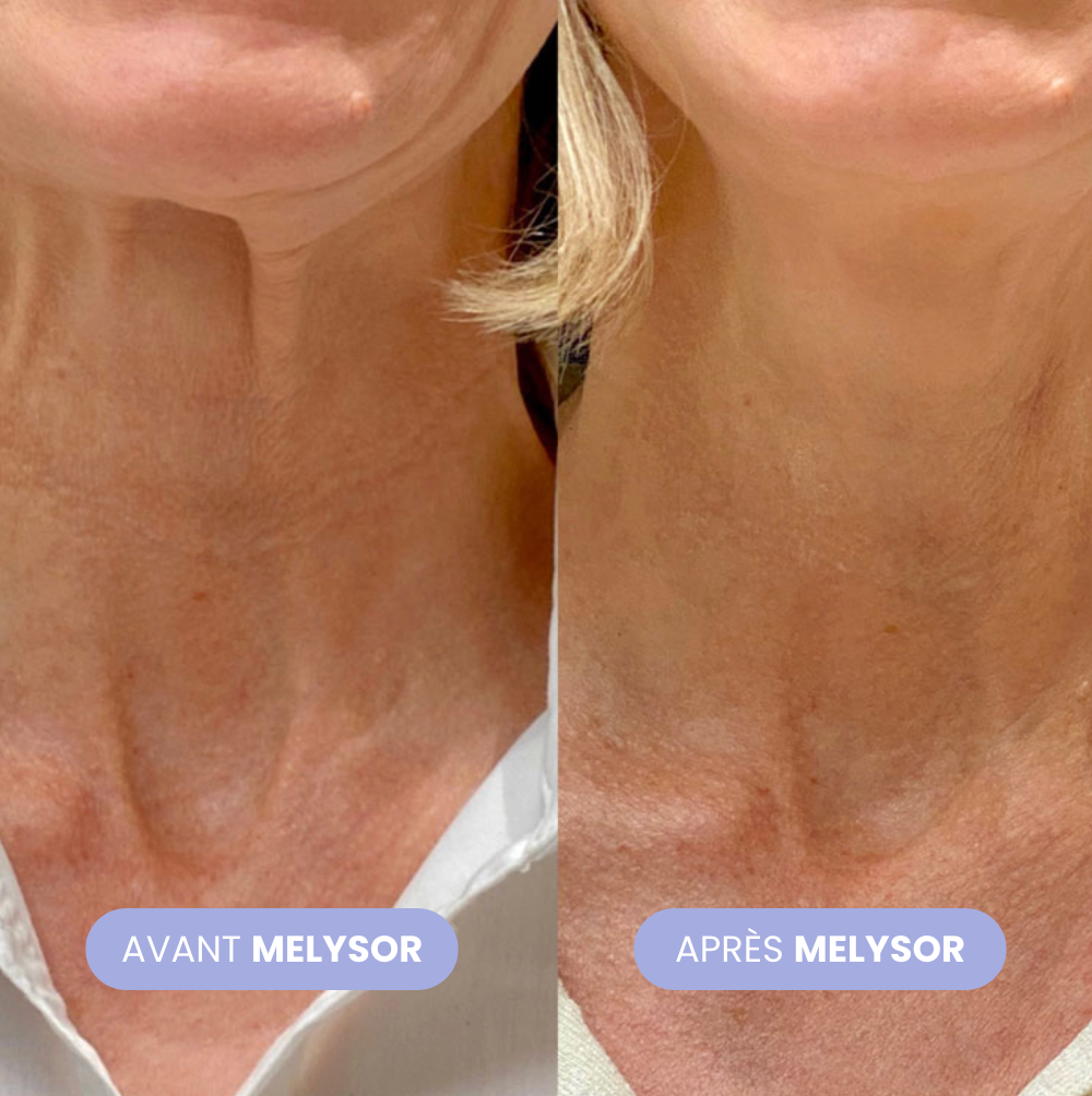 Crème Lifting Cou