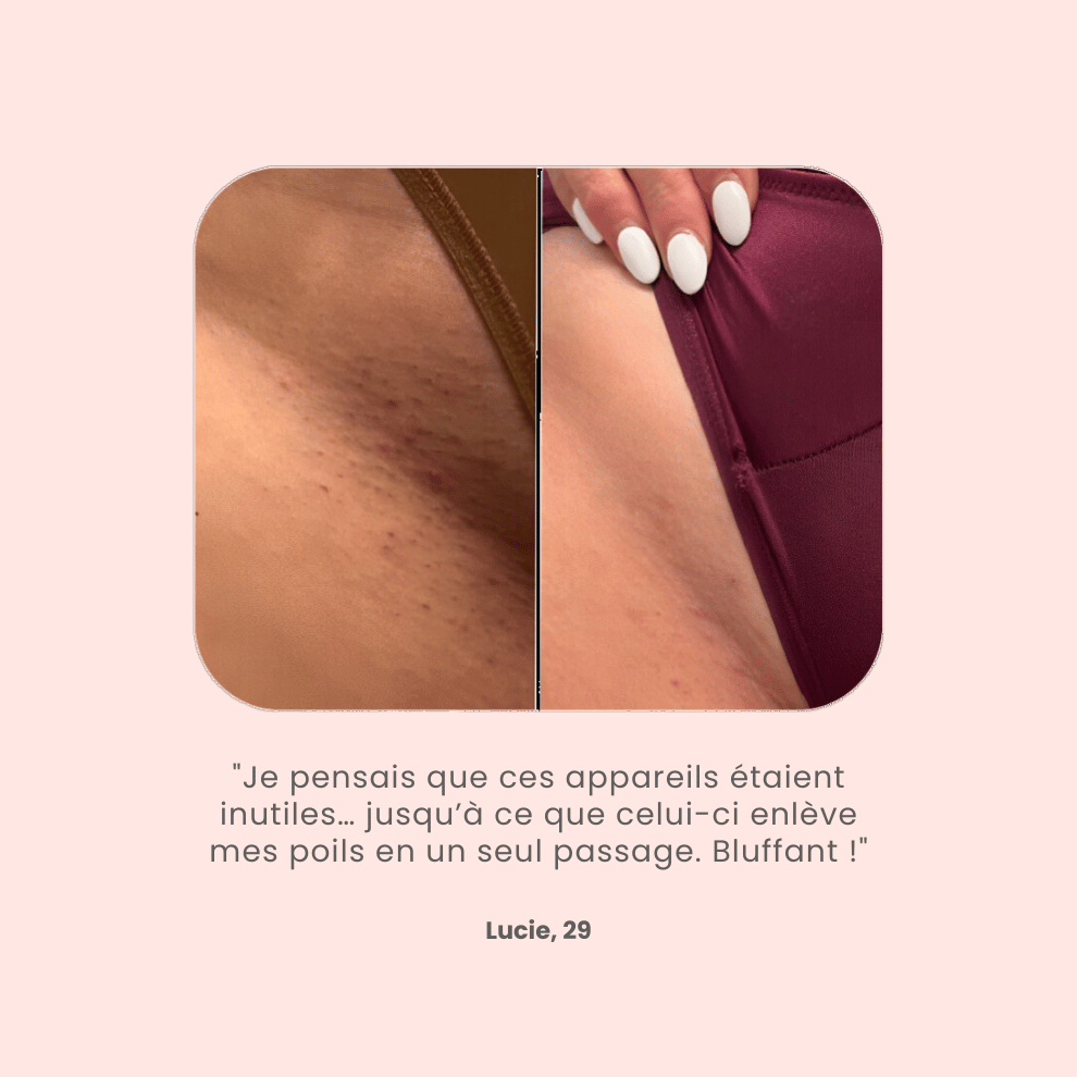 Épilateur électrique rechargeable sans douleur