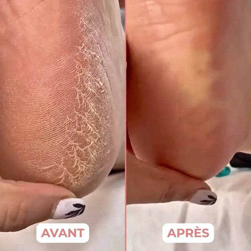 Appareil électrique soin des pieds