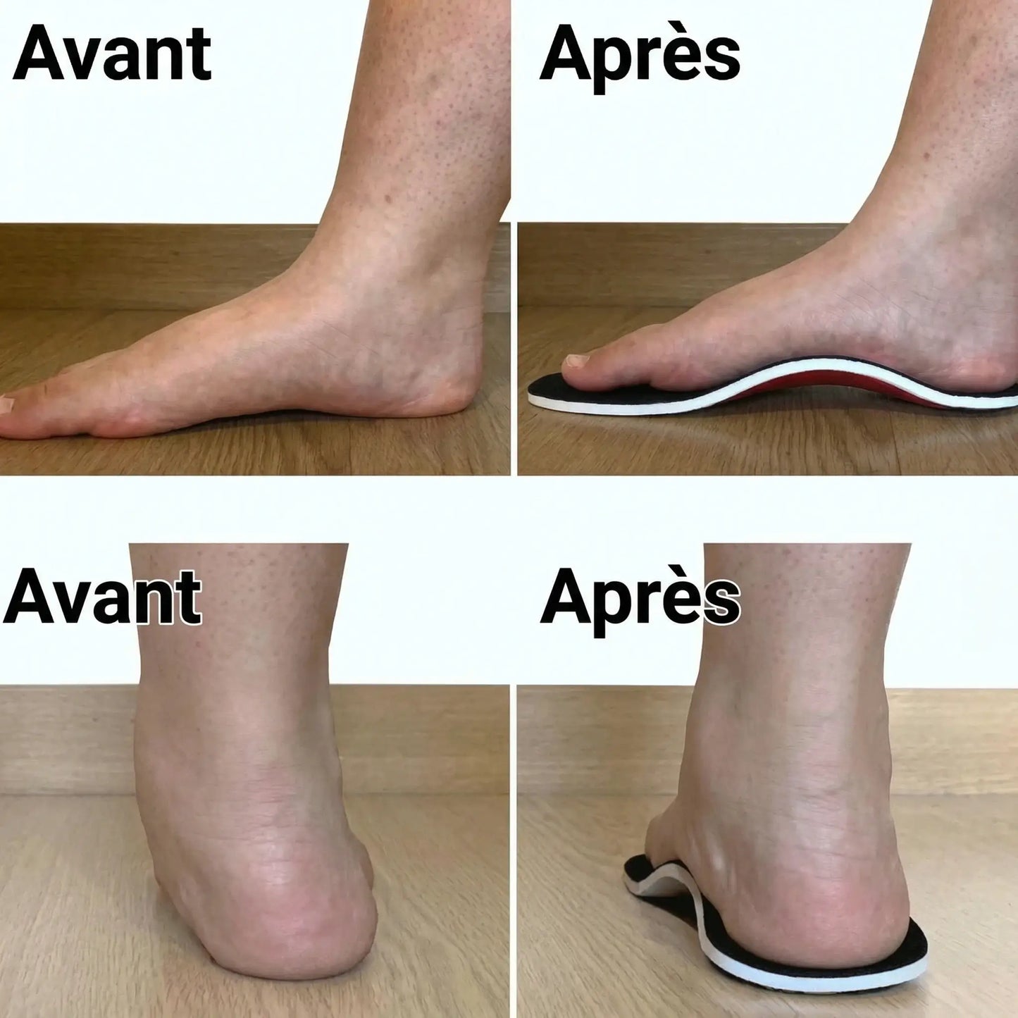 Semelles de Soutien pour Voûte Plantaire