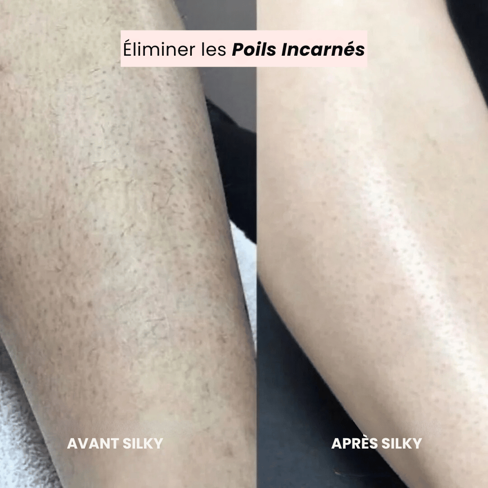 Épilateur électrique rechargeable sans douleur