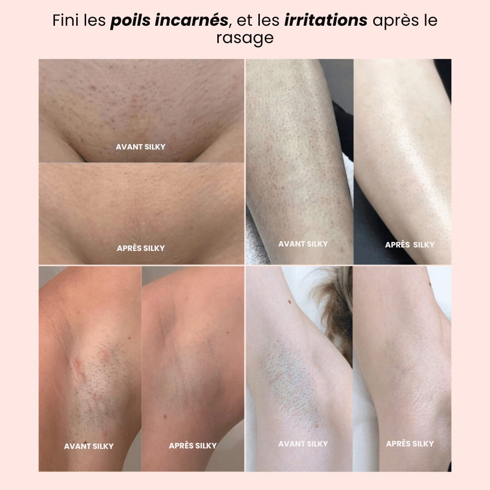 Épilateur électrique rechargeable sans douleur