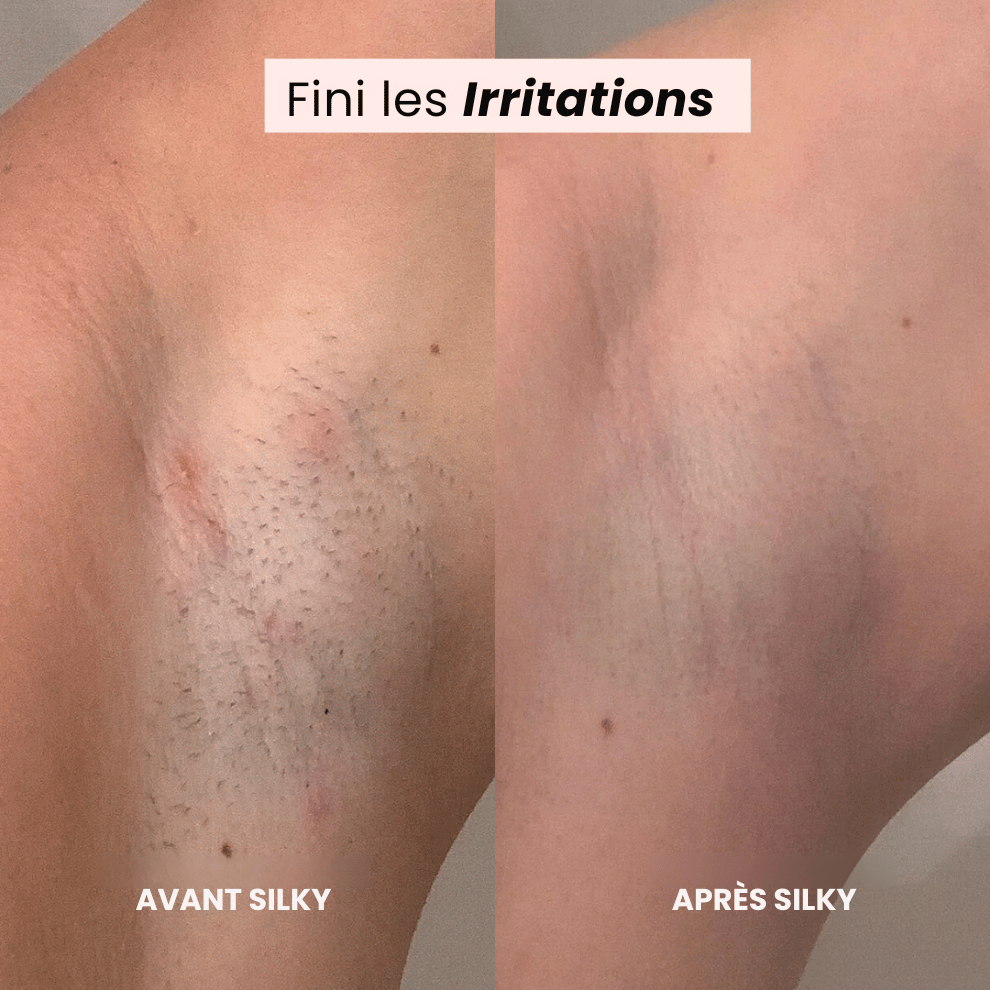 Épilateur électrique rechargeable sans douleur