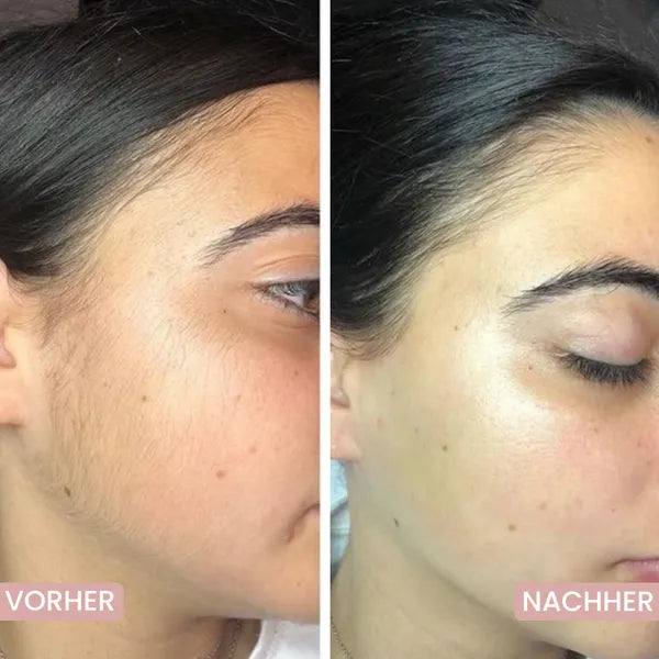 Hautfreundlicher 5-in-1-Rasierer für empfindliche Hautpartien