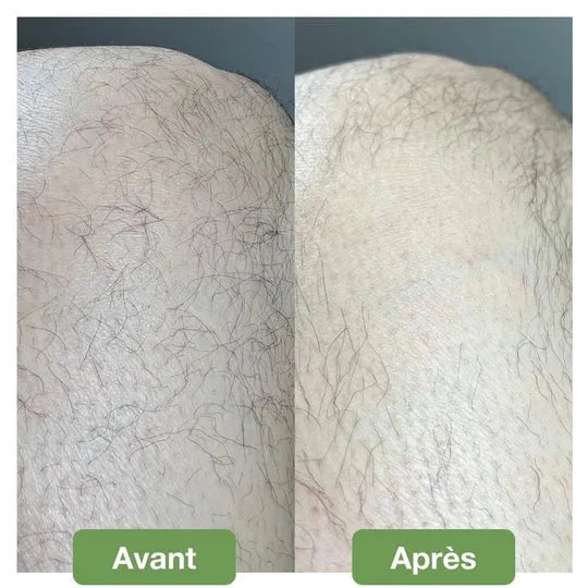 Gomme d’Épilation Douce