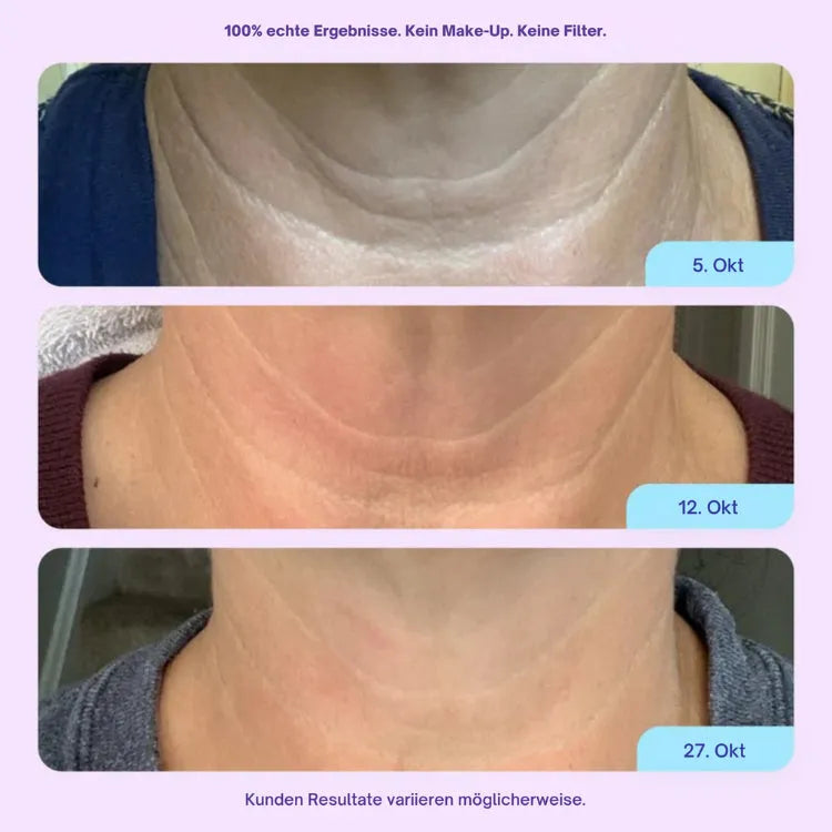 Pad cervical en silicone médical