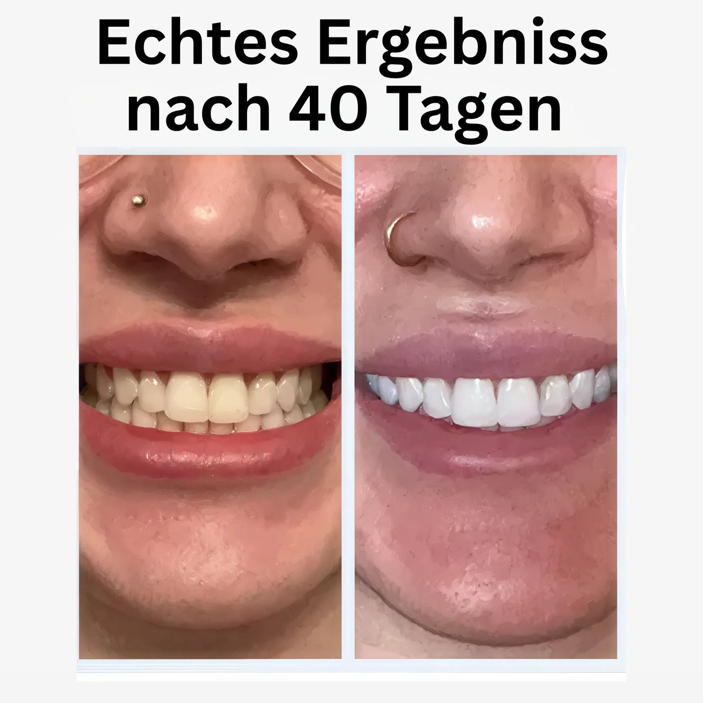 Automatische Schallzahnbürste