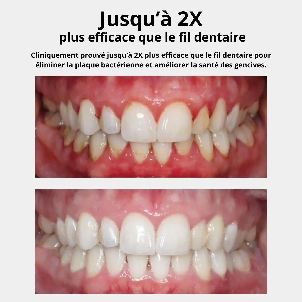 Hydropulseur dentaire