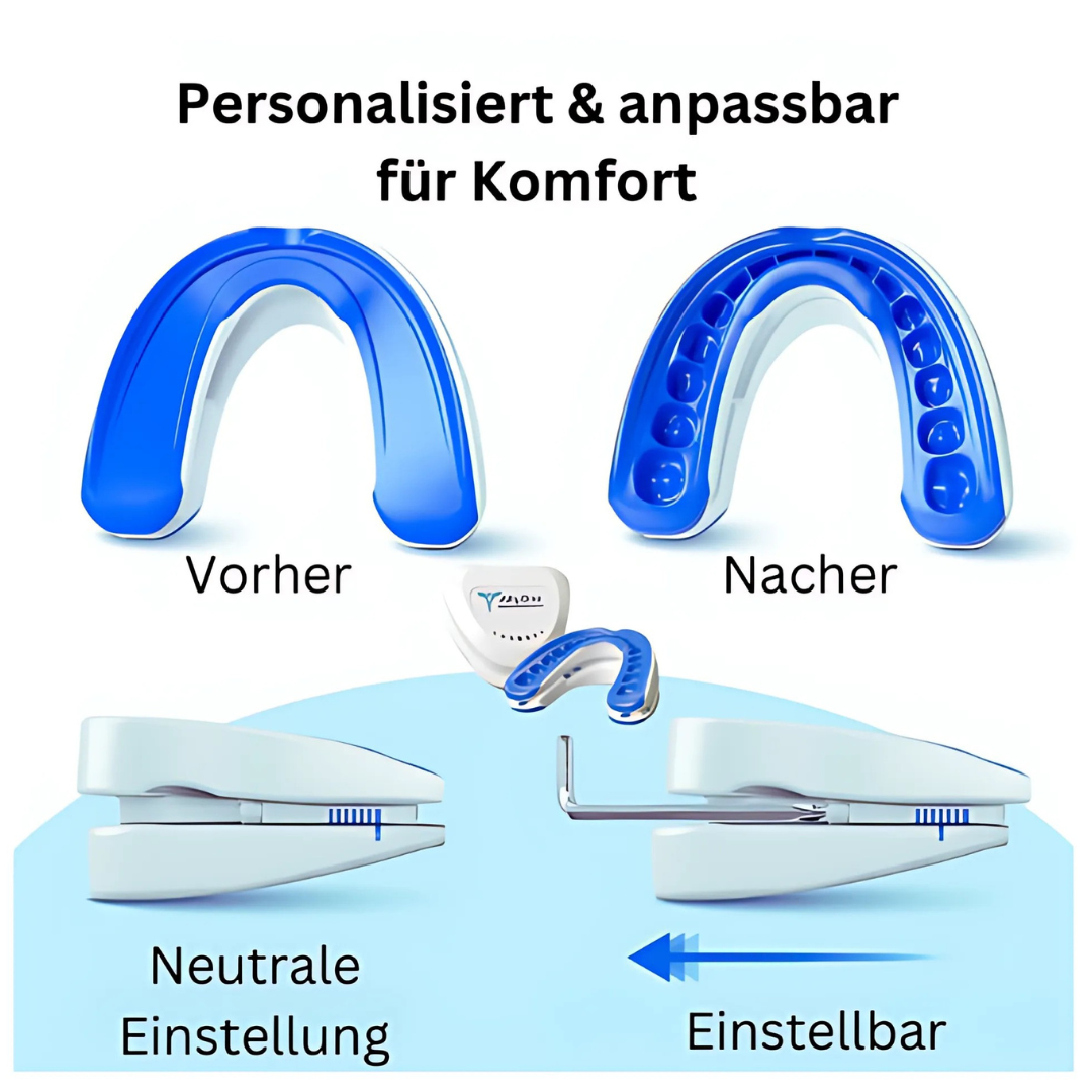 Anti-Schnarch-Zahnschiene