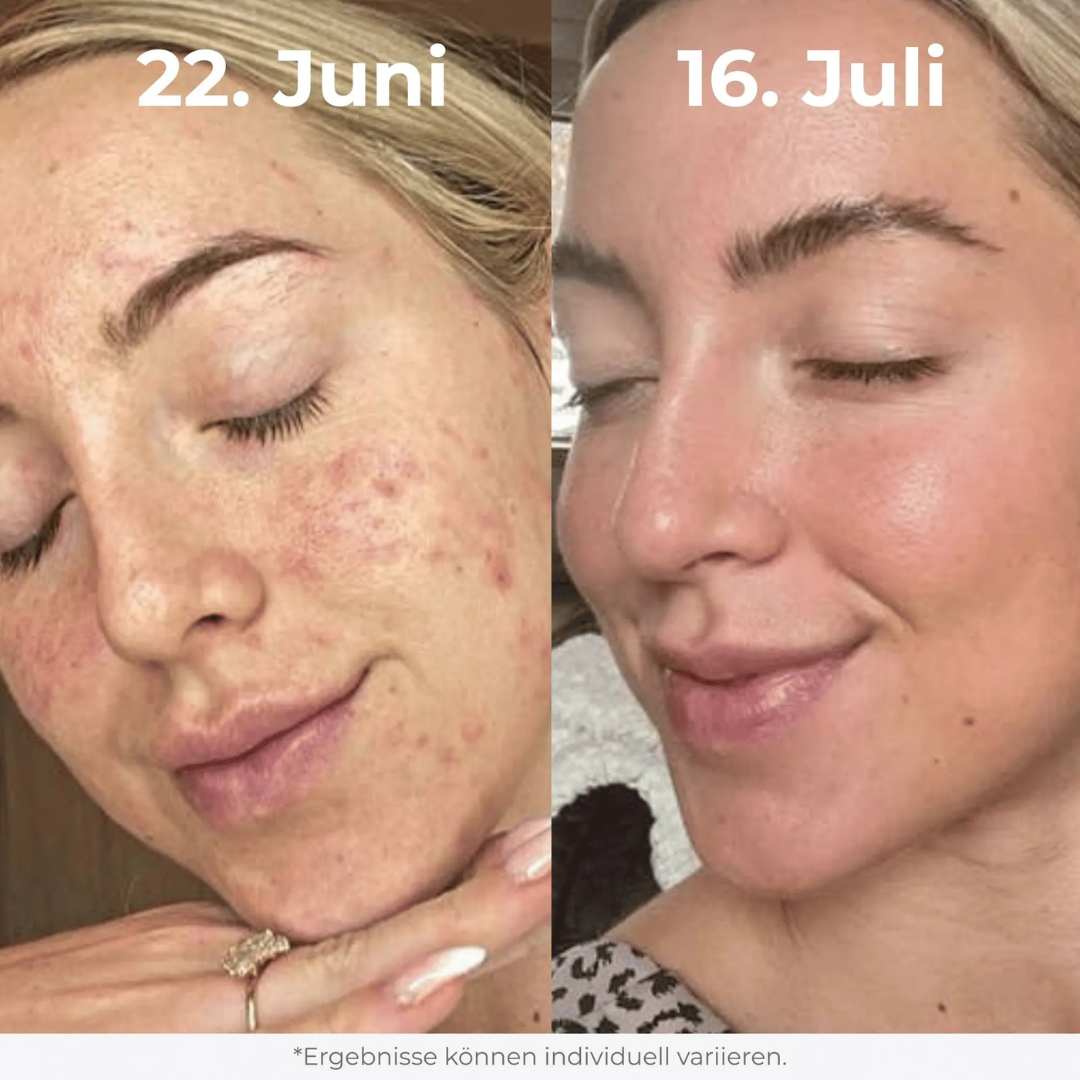 Glow Rice Peeling Duo