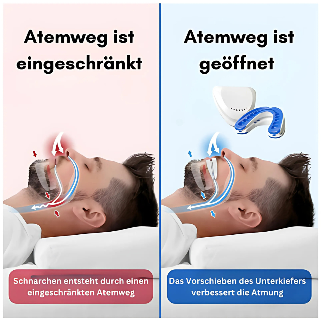 Anti-Schnarch-Zahnschiene