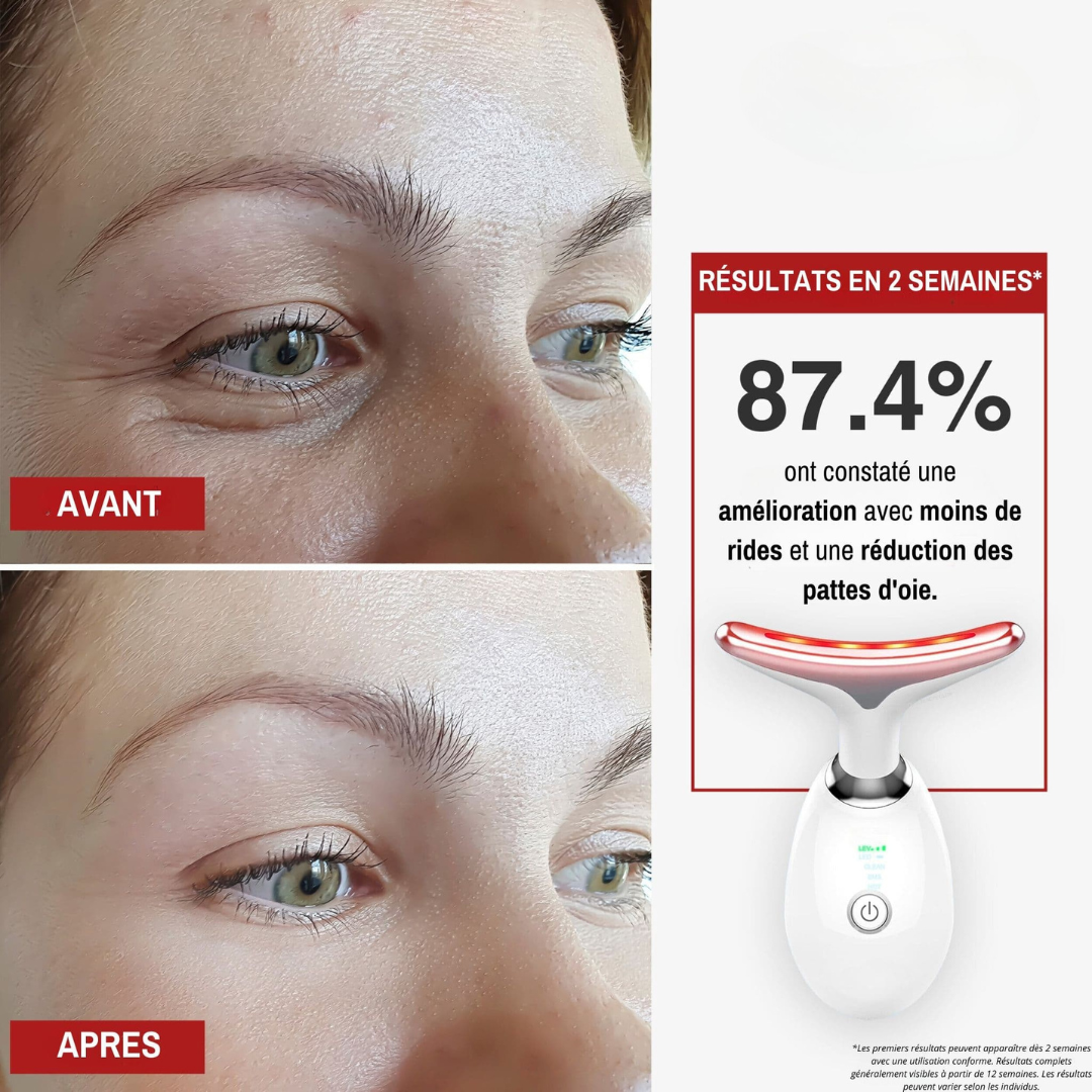 Anti-Aging-Gerät für das Gesicht mit LED-Licht