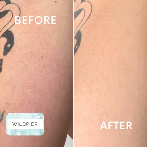 Peeling-Handschuh - Entfernt abgestorbene Hautschüppchen