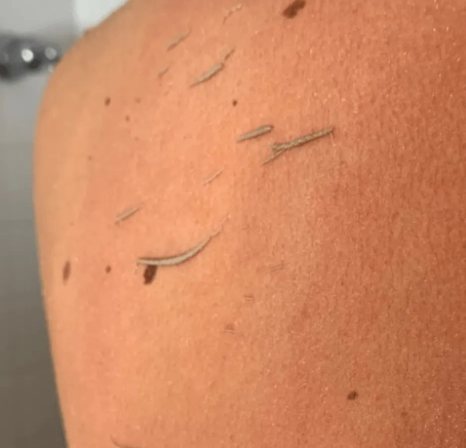 Peeling-Handschuh - Entfernt abgestorbene Hautschüppchen