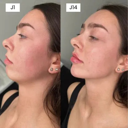Gesichtsmaske Fit Mask