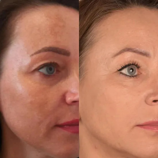 7-in-1-Gesichtssculptor