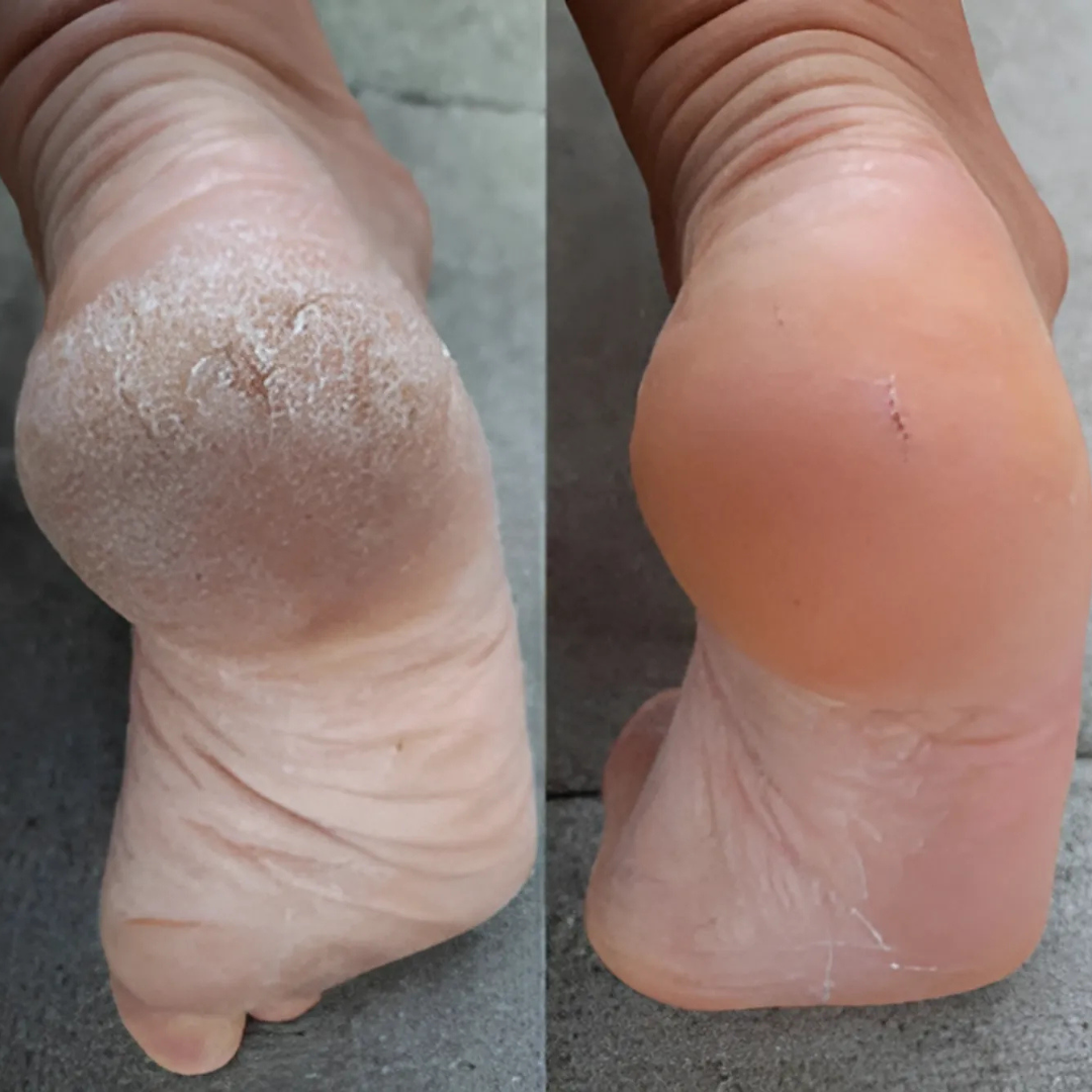 Raspa elettrica ricaricabile