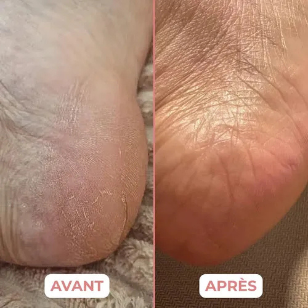 Apparecchio elettrico per pedicure