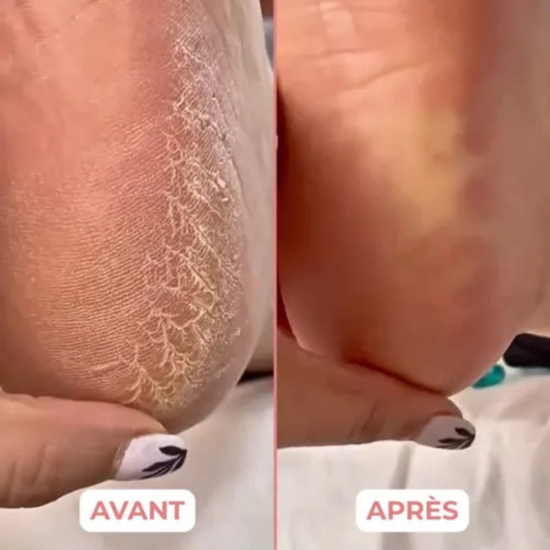Apparecchio elettrico per pedicure