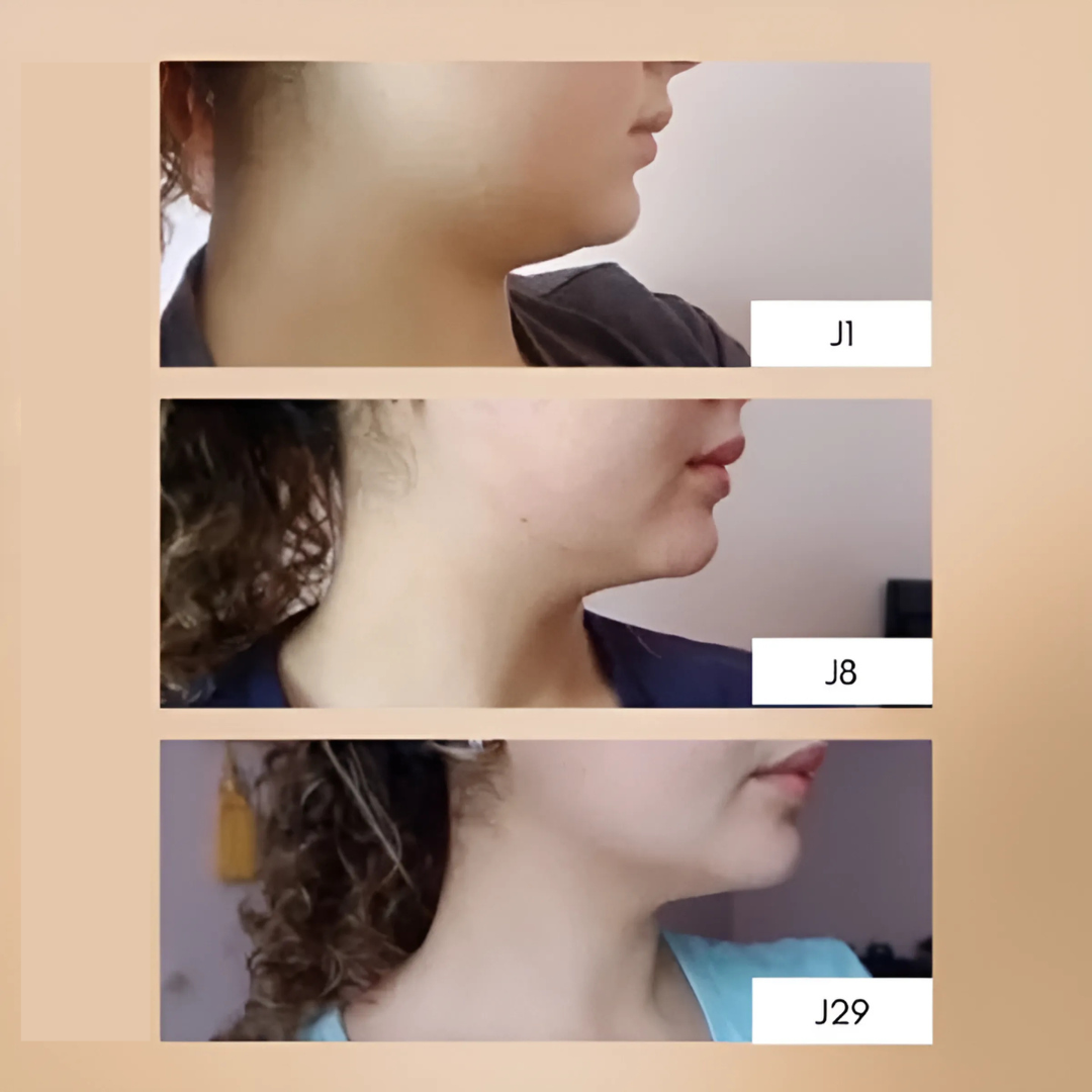 Maschera Fit Face Girdle