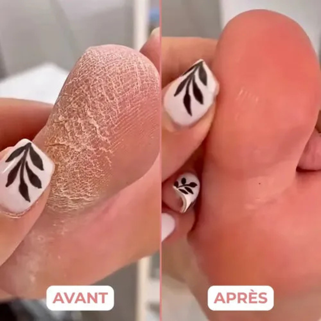 Apparecchio elettrico per pedicure