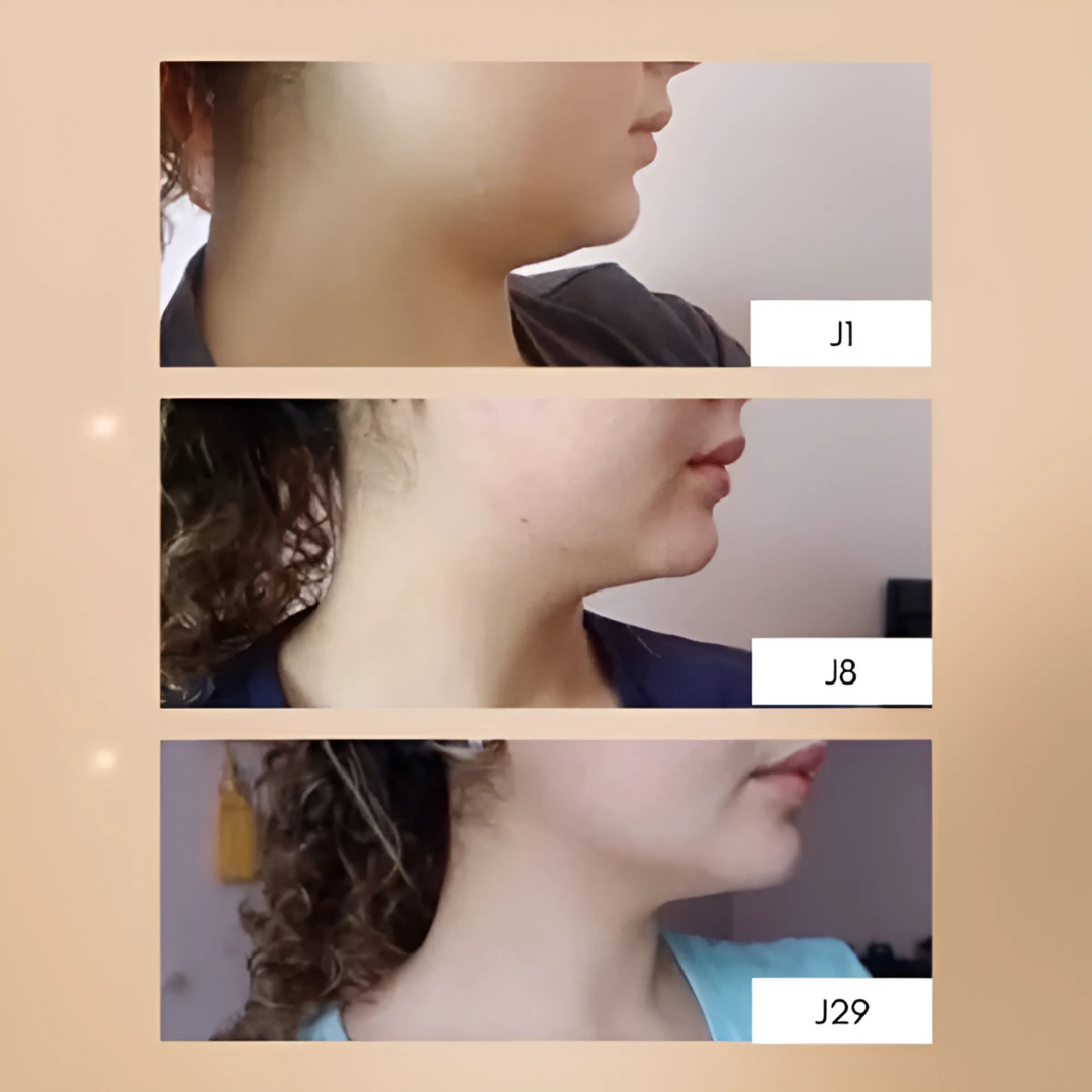 Maschera viso rassodante riutilizzabile con effetto lifting