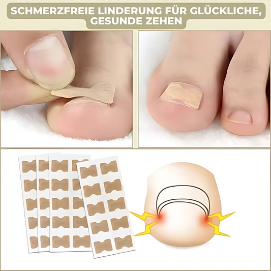 Cerotti FixaNail Sofortige Nagelreparatur - 25 + 25 Gratis